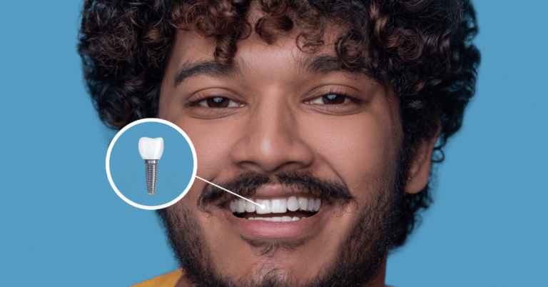 screw in teeth