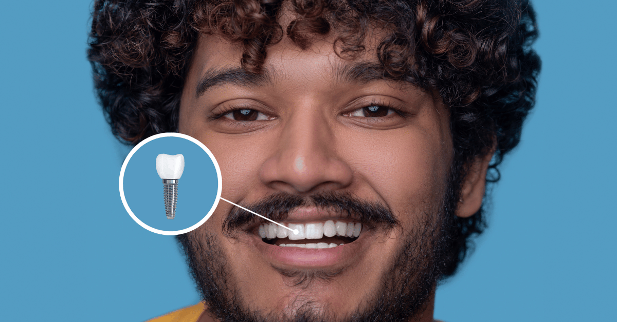 screw in teeth