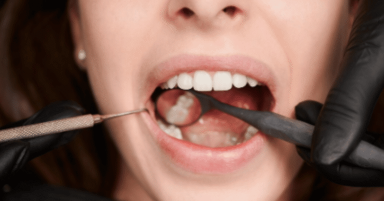 back molars