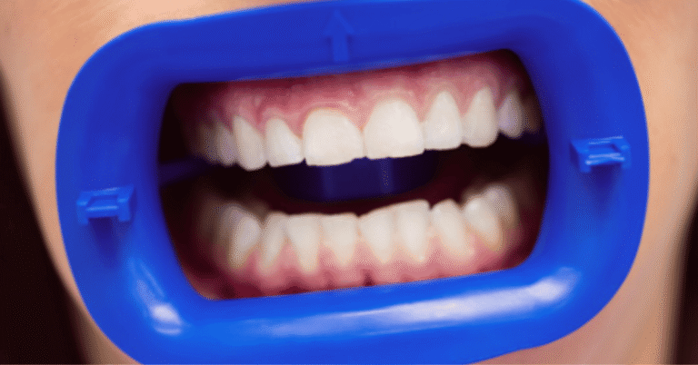front tooth crown
