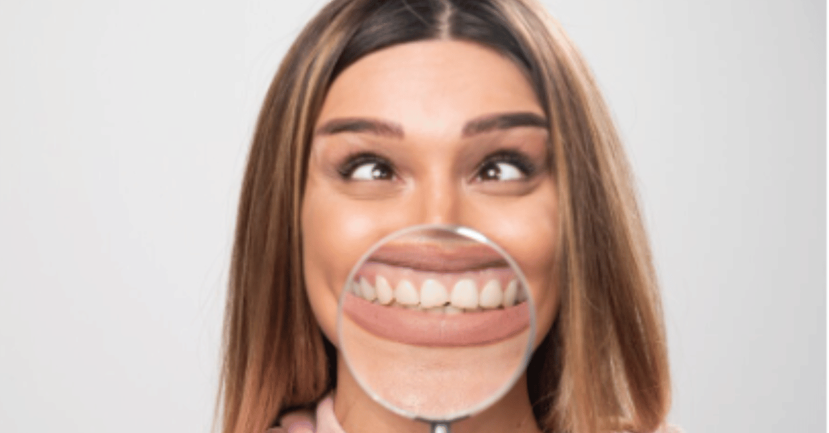 gum contouring