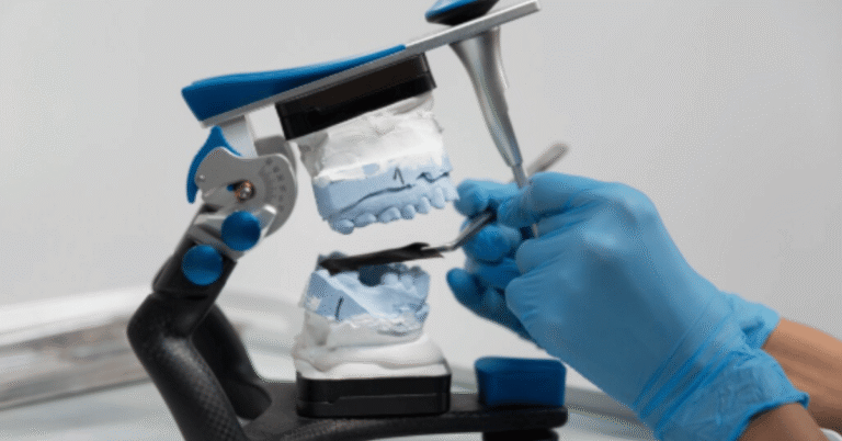 implantes dentales