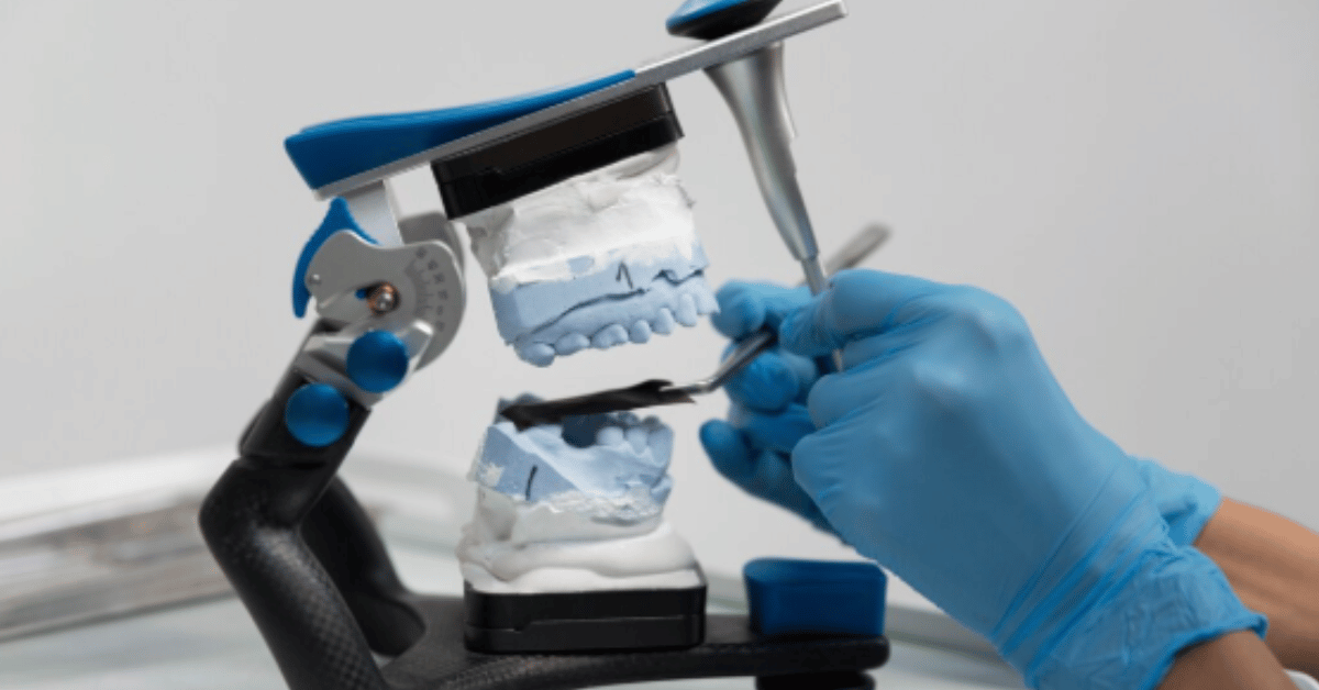 implantes dentales