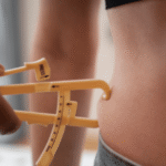 liposuccion