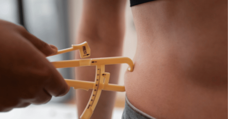 liposuccion