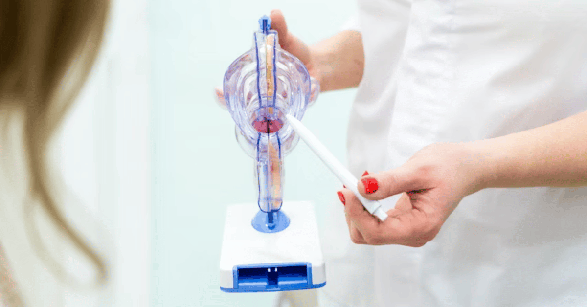 speculum specula
