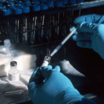 short synacthen test